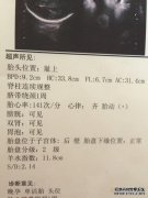 hc胎儿是什么意思？