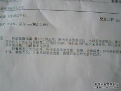 CT后我害怕受到伤害