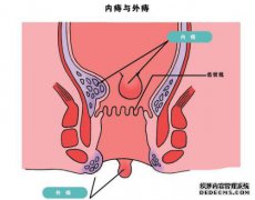 我怪，凳子上有凹槽，凳子不是圆柱形的，请.