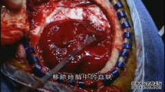 什么是净视图？