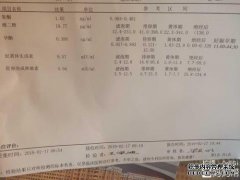妇产科医生帮我看我排卵正常，睾丸激素过高吗