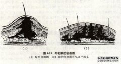 临床症状