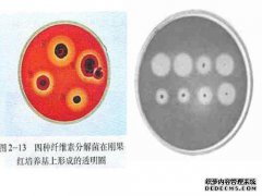 分解纤维素的微生物的分离计划。