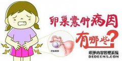 如何获得卵巢囊肿？