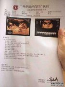 Nt在生产中的含义是什么，什么是项目？