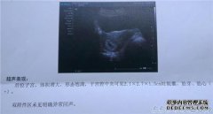 [妊娠与妊娠囊有什么区别？