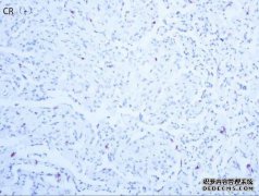 CK在免疫组化中