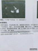 对于NT试验，该报告说：“颈部后面的透明层的厚