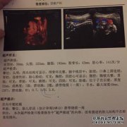 如何将胎儿放在脖子上？