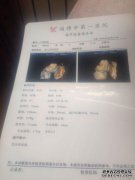super single b是什么意思？