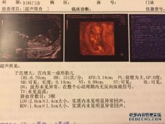 怀孕13周4天，使NT胎儿的脸部不清楚，通常
