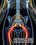 右髋关节臀肌（坐骨神经囊肿）